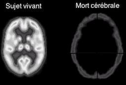 Pourquoi doit-on communiquer avec les personnes en état végétatif ?